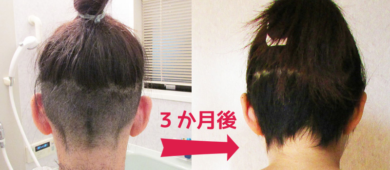 ツーブロック女子伸びかけ