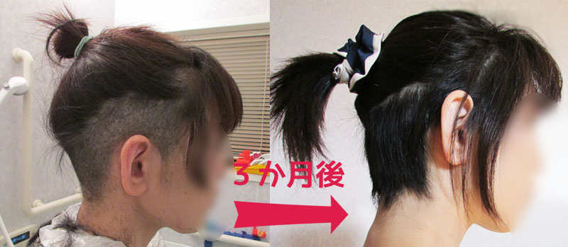 ツーブロック女子伸びかけ