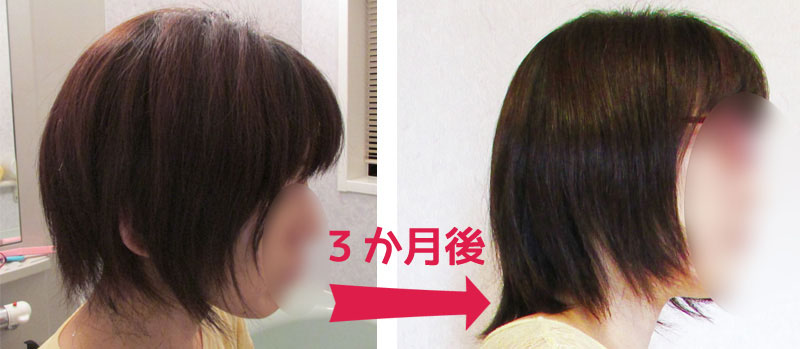 ツーブロック女子伸びかけ